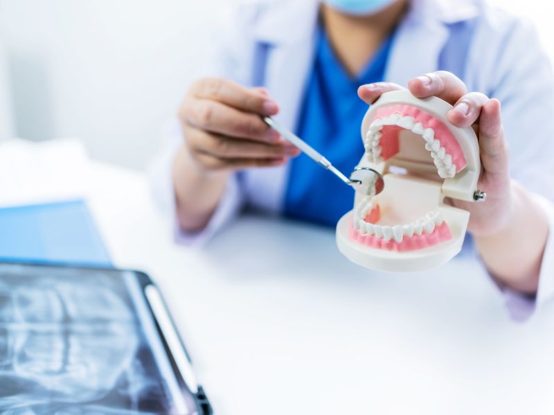 Porcelain Dental Bridges